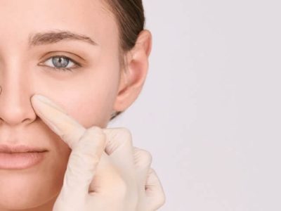 DEVIATED SEPTUM AND SEPTOPLASTY SURGERY