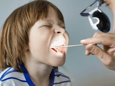 TONSIL DISEASES AND TONSIL SURGERY (TONSILLECTOMY)